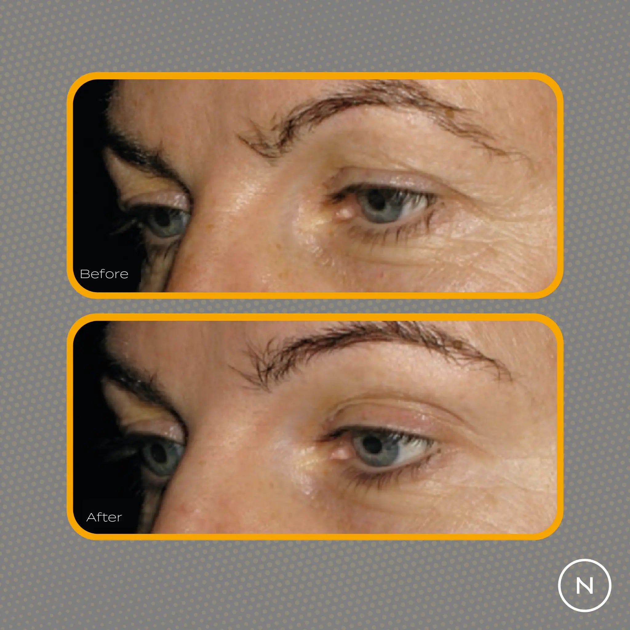 Kollageeni peptidi ennen jälkeen