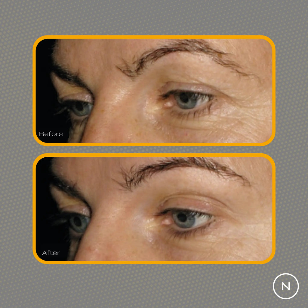 Kollageeni peptidi ennen jälkeen