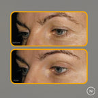 Kollageeni peptidi ennen jälkeen